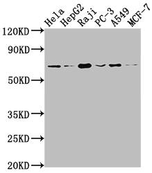 Alas1 Antibody (2A9)