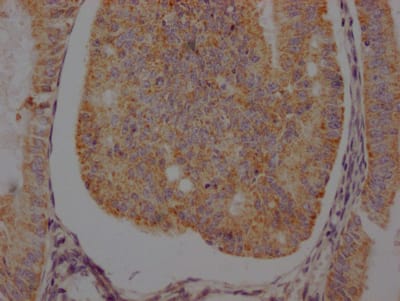 beta-2 Adrenergic R/ADRB2 Antibody (4C11)