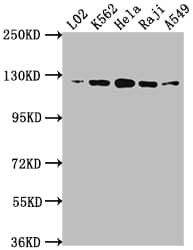 ATP Citrate Lyase Antibody (3A5)