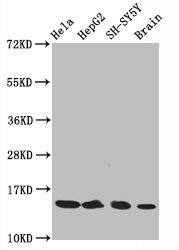 Histone H3.1 [ac Lys14] Antibody (3H3)