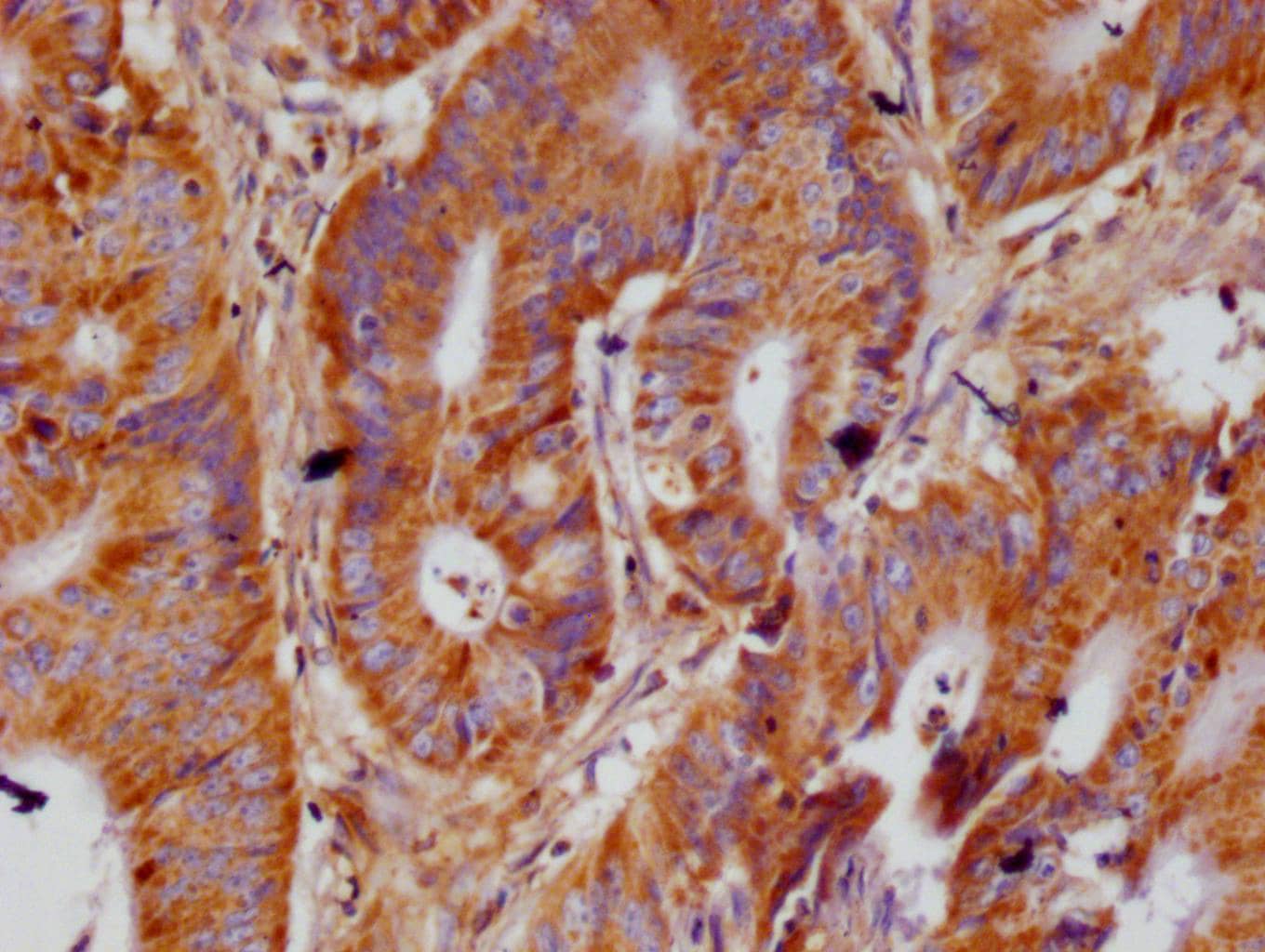 ACAA2 Antibody (12F4)