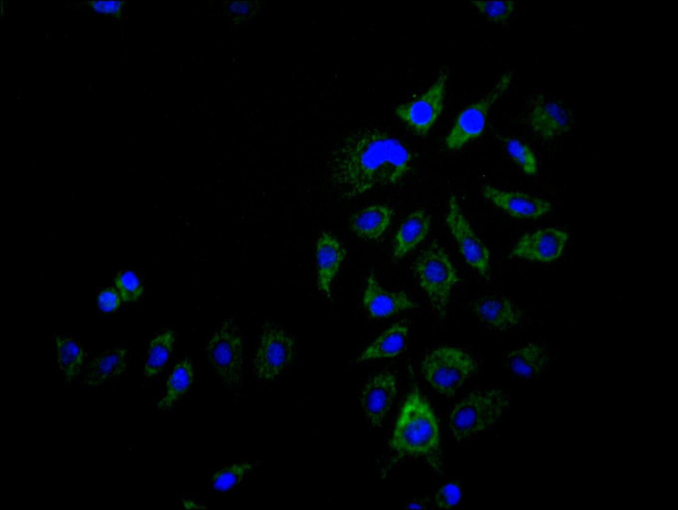 ACAA2 Antibody (12F4)
