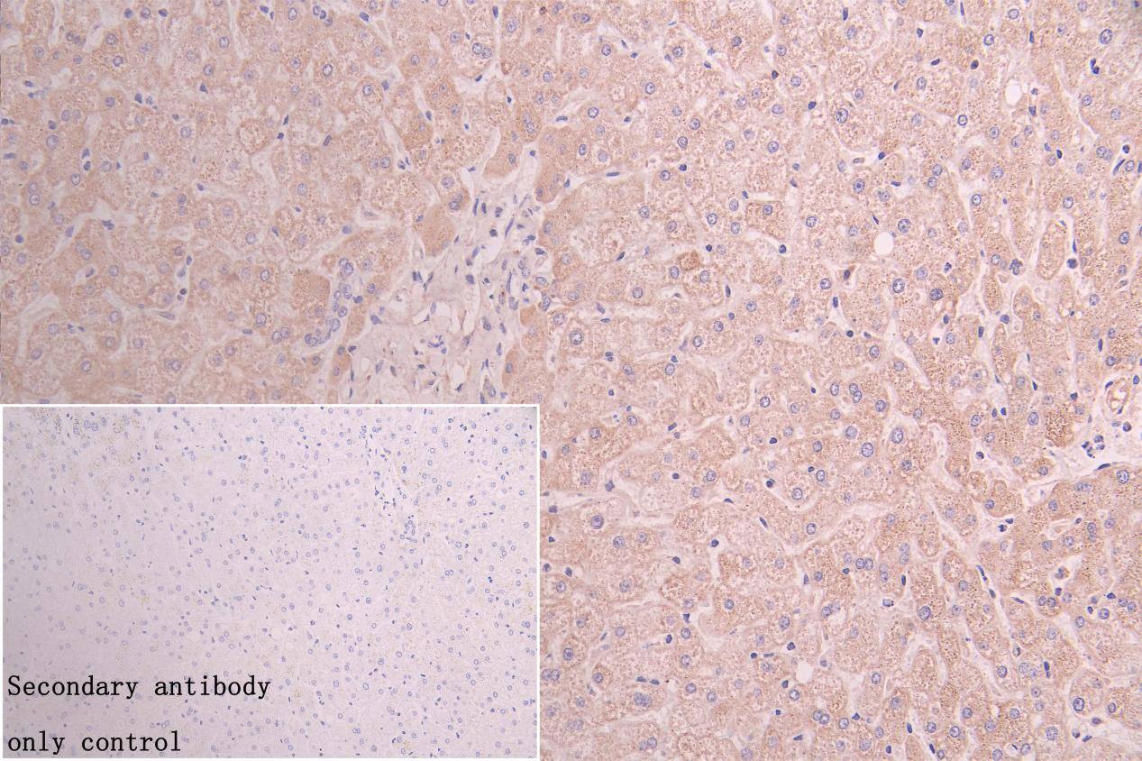 ACAA2 Antibody (12F4)