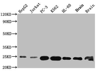 Glutathione S-Transferase pi 1/GSTP1 Antibody (8F6)