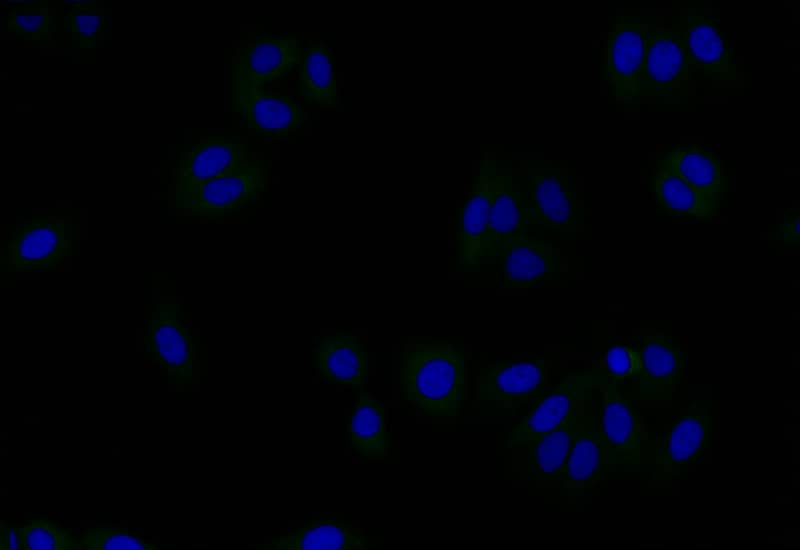 Gelsolin/GSN Antibody (16H9)