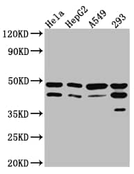 GSK-3 beta Antibody (9G11)