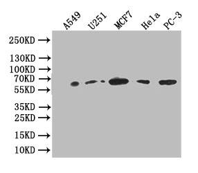 Glucose 6 phosphate isomerase Antibody (12A4)