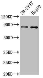 GOLM1 Antibody (9C2)