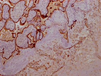 Growth Hormone Antibody (5E9)