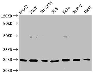 GDNF Antibody (11D2)