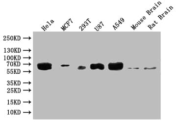 Glucosylceramidase/GBA Antibody (4H4)