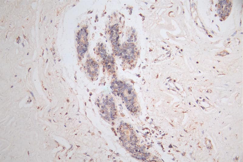 LYAG/GAA Antibody (5E5)