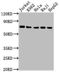 FUBP1 Antibody (7C3)