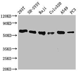 FTO Antibody (4G9)