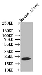 Ferritin Antibody (39G3)