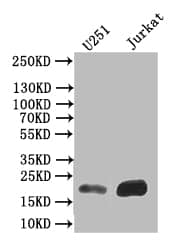 Ferritin Antibody (12H1)