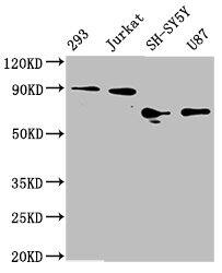 FOXO3 Antibody (1E2)