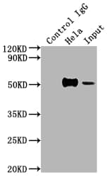 HNF-3 alpha/FoxA1 Antibody (3B2)