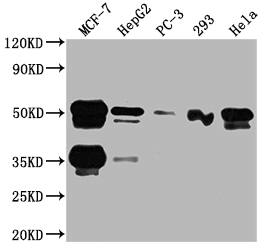 HNF-3 alpha/FoxA1 Antibody (3B2)
