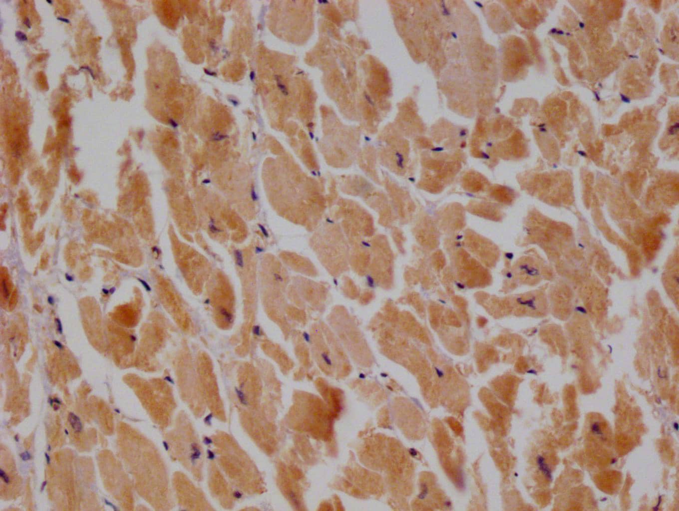 TTC11 Antibody (27B4)