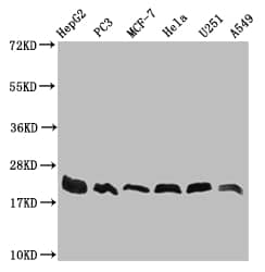 TTC11 Antibody (27B4)