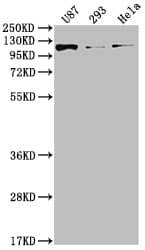 FGFR3 Antibody (6D4)