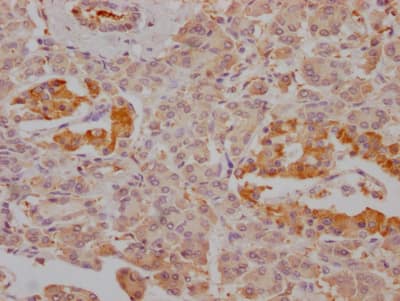 FBPase 1 Antibody (4G3)