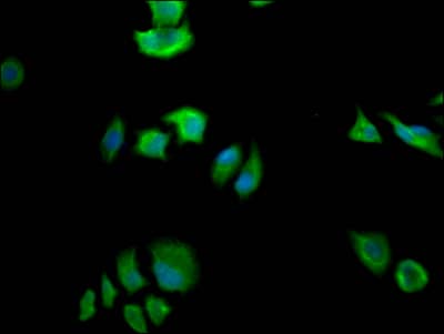 Fatty Acid Synthase/FASN Antibody (2A5)