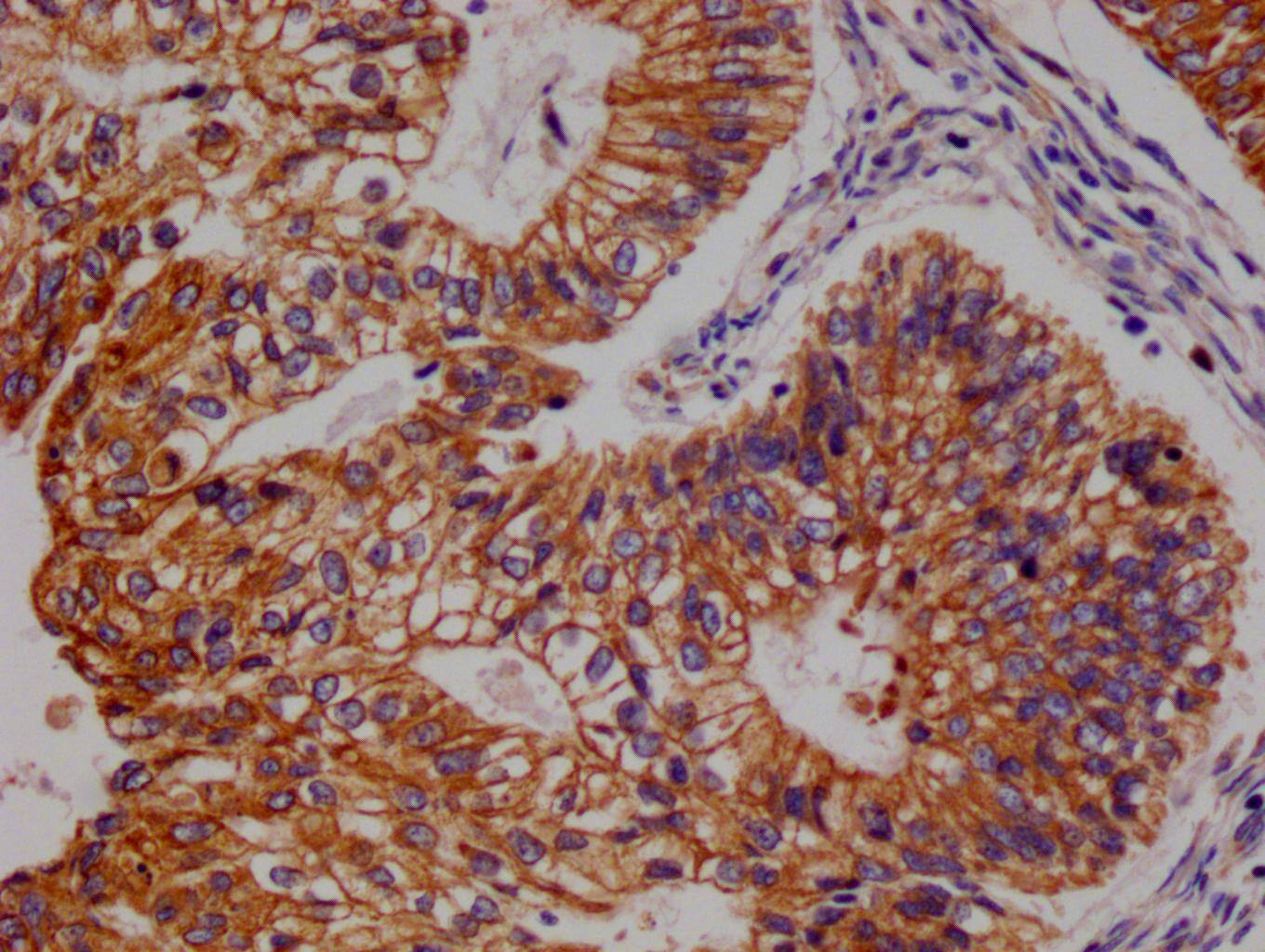 FADS1 Antibody (7A10)