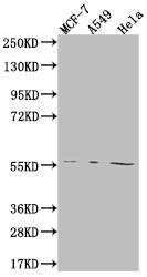 FADS1 Antibody (7A10)