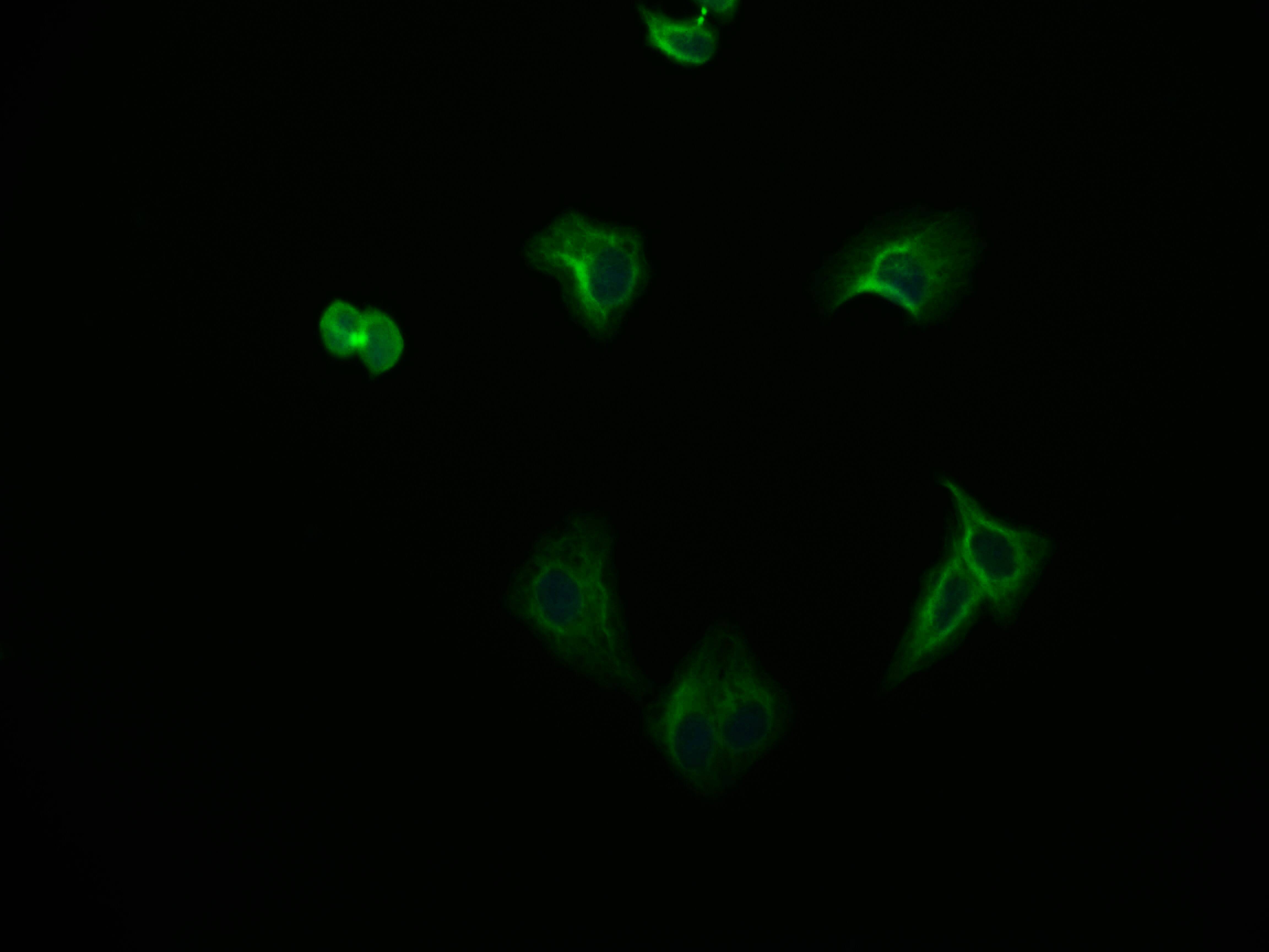 FADS1 Antibody (7A10)
