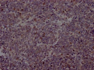 EZH2/KMT6 Antibody (2C7)