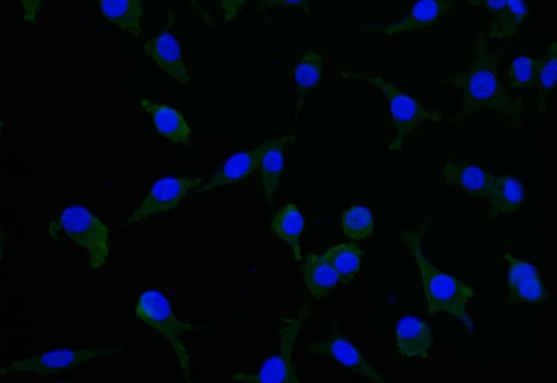 CRMP2 Antibody (20D8)
