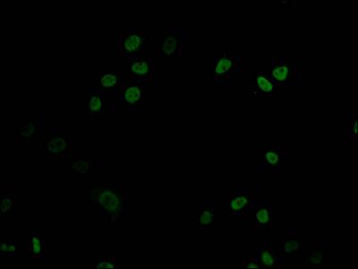 DNMT1 Antibody (1A9)