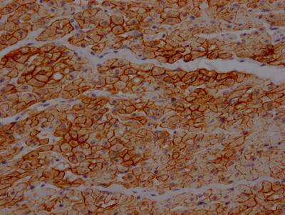 Dystrophin Antibody (4B10)