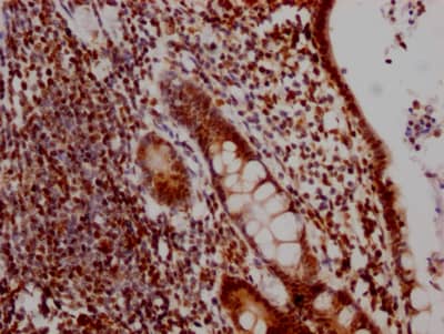 DDX5 Antibody (2C3)