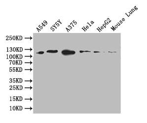 DDR2 Antibody (9A9)