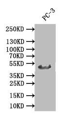 XPE/DDB2 Antibody (24E5)