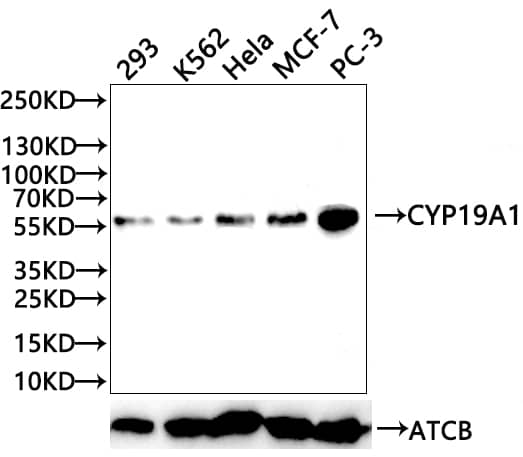 Aromatase Antibody (1H1)