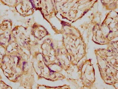 Aromatase Antibody (1H1)