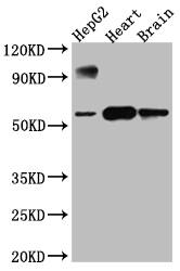 Cytochrome P450 17A1 Antibody (5A9)
