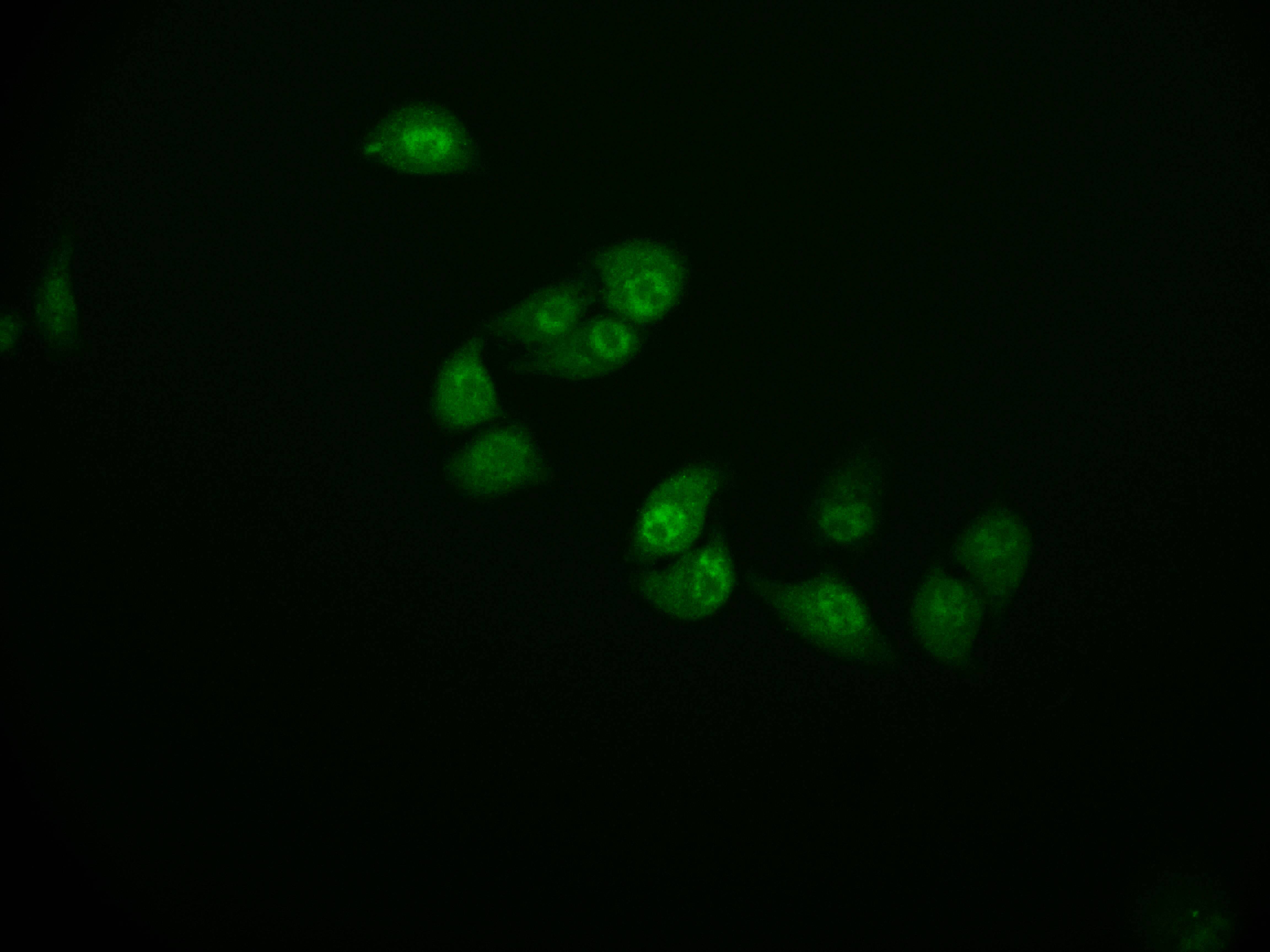 Cystatin B/Stefin B Antibody (11H4)