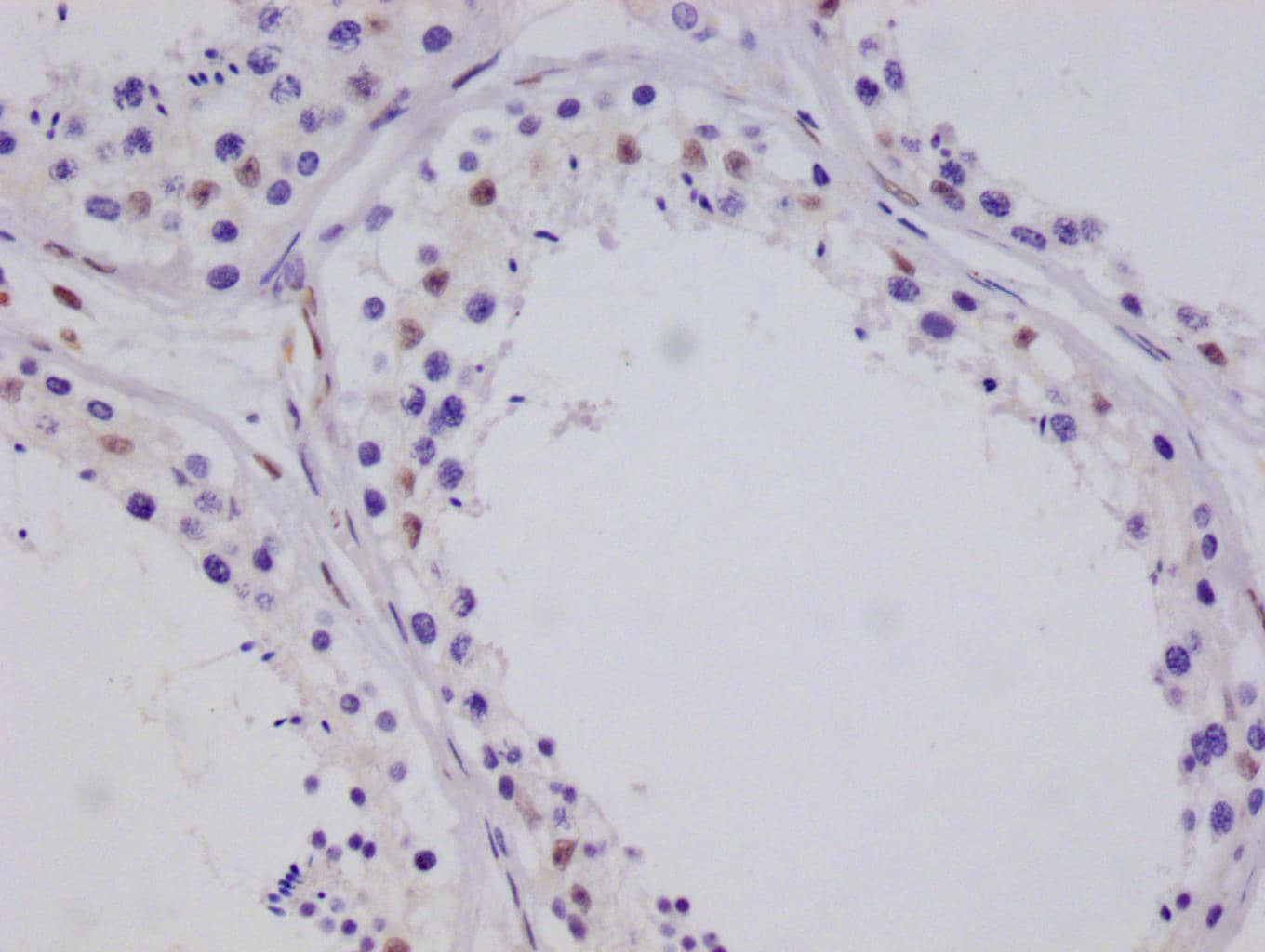 TORC3/CRTC3 Antibody (10G3)