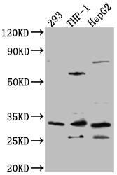 COMT Antibody (8E1)