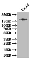 Collagen XVII Antibody (15G9)