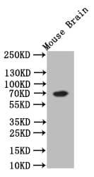 Choline Acetyltransferase/ChAT Antibody (8E7)