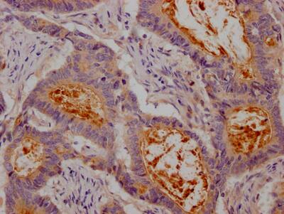 CEACAM1/CD66a Antibody (10H8)