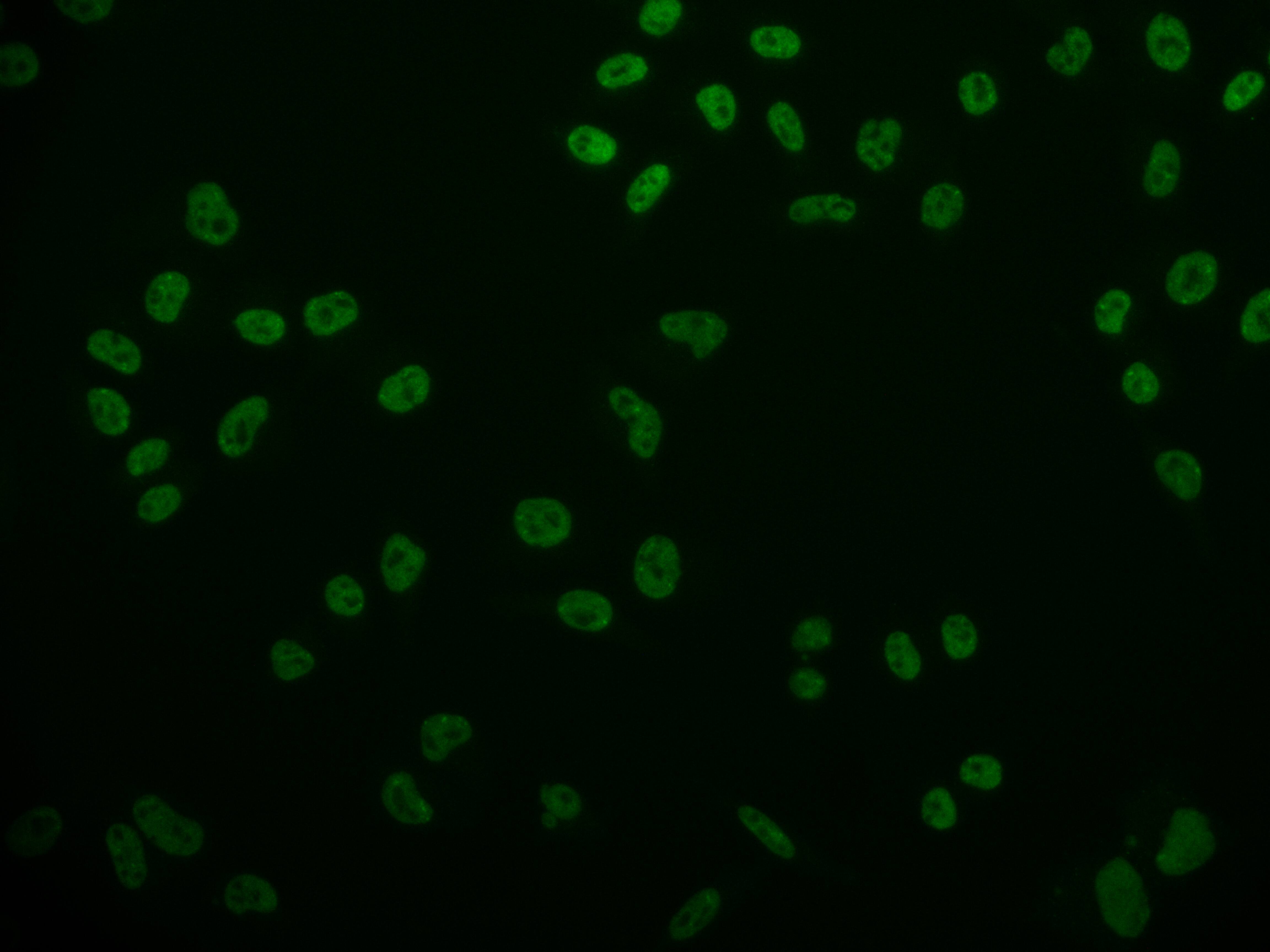 Cdx1 Antibody (11E10)