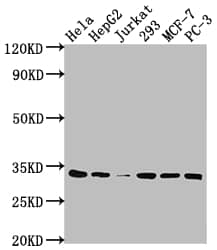 CDK4 Antibody (8F2)