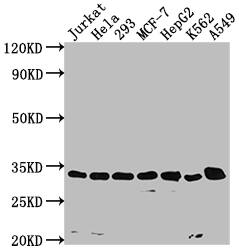 CDK4 Antibody (8H4)